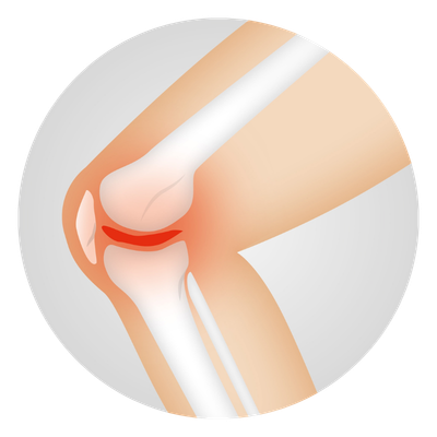 Joint Care